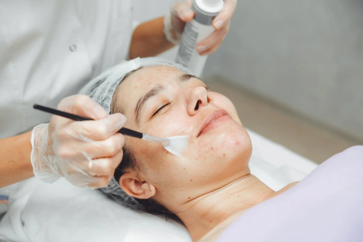 Lady undergoing acne scar treatment at aesthetics clinic.