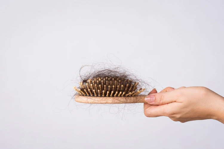 A bundle of hair clumped on a comb after hair brushing which indicates hair loss issues.