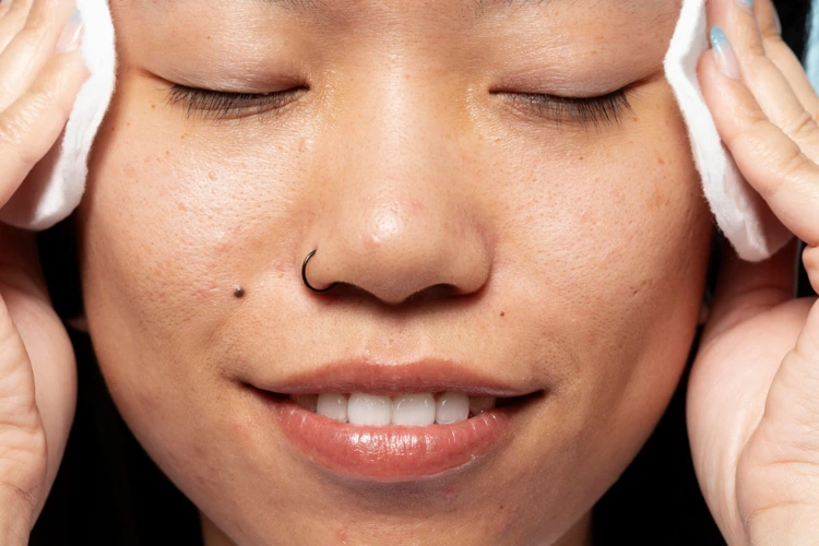 Female patient with a mole near her right nose ridge.