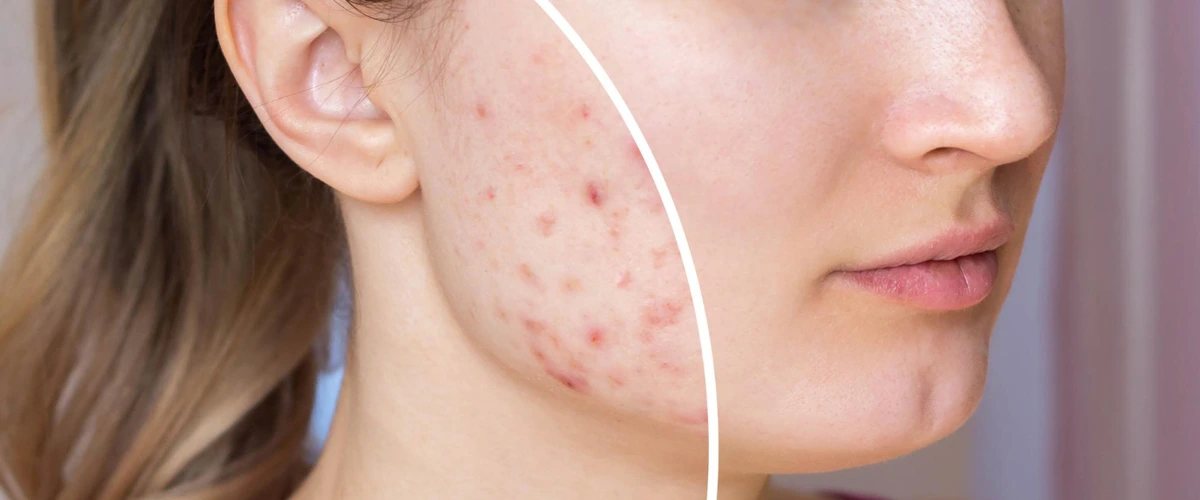 Healthy and balanced meal with exercise equipment and stethoscope on table.